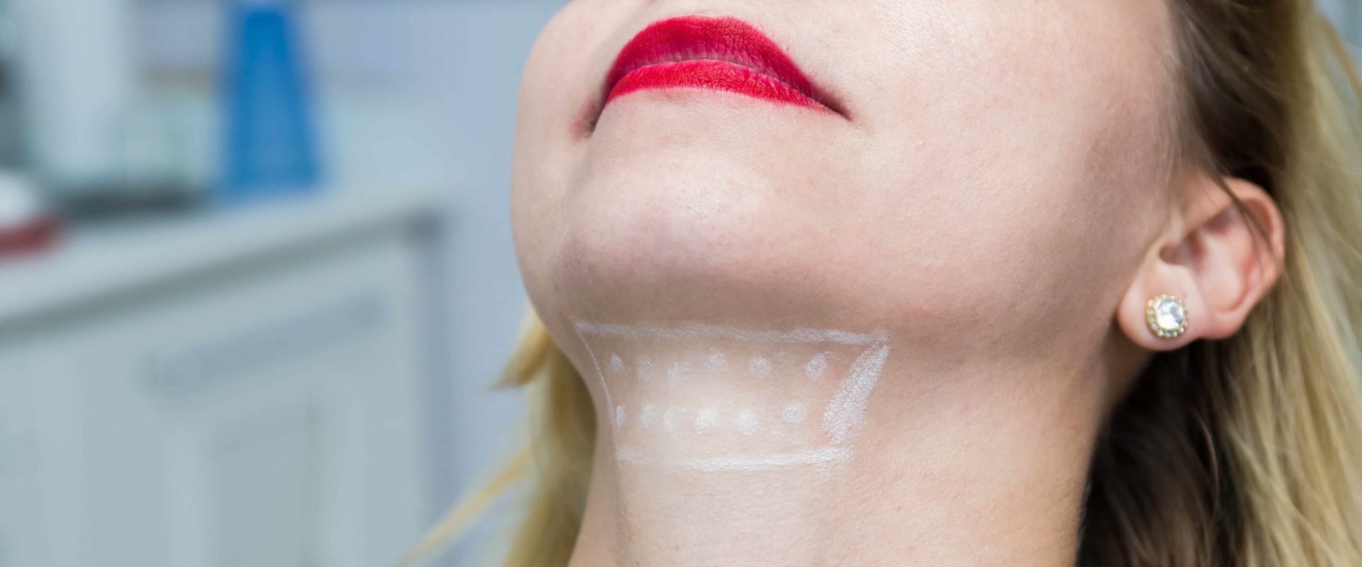 An Introduction to Kybella Treatment Process