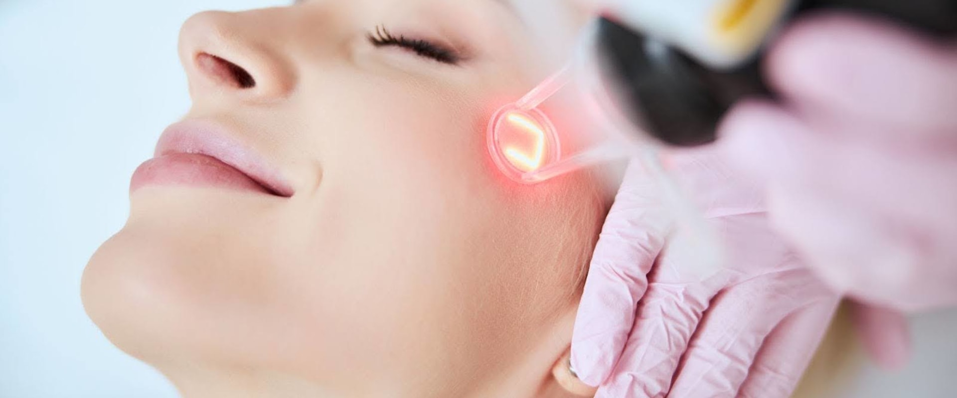 All You Need to Know About Laser Skin Resurfacing