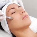 Understanding Microdermabrasion and Other Aesthetic Treatments