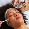 Chemical Peels: A Comprehensive Guide to Medical Aesthetic Spas