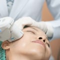 An In-Depth Look at Ultherapy: The Ultimate Guide to Medical Aesthetics Spas