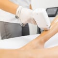 The Magic of Laser Hair Removal: Before and After Photos