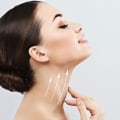 A Comprehensive Guide to Neck Lift Procedures