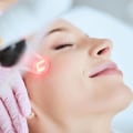 All You Need to Know About Laser Skin Resurfacing