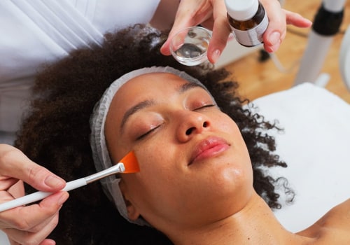 Chemical Peels: A Comprehensive Guide to Medical Aesthetic Spas