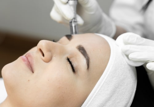 The Ultimate Guide to Microneedling for Skin Rejuvenation and Anti-Aging