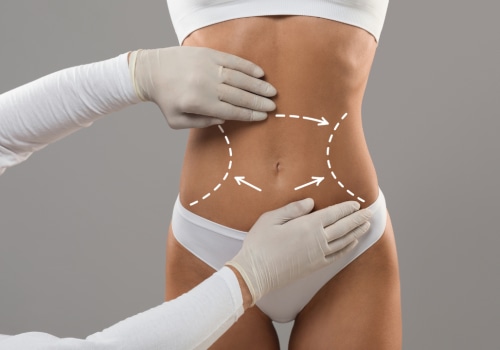 How Body Contouring Works: A Comprehensive Guide