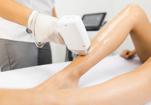 The Magic of Laser Hair Removal: Before and After Photos