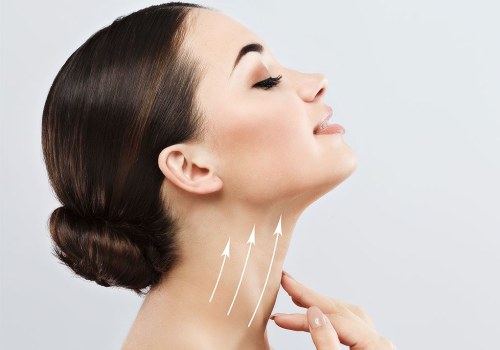 A Comprehensive Guide to Neck Lift Procedures