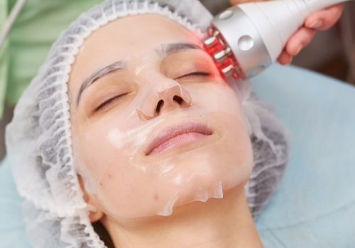 Understanding Radiofrequency Skin Tightening: A Comprehensive Guide